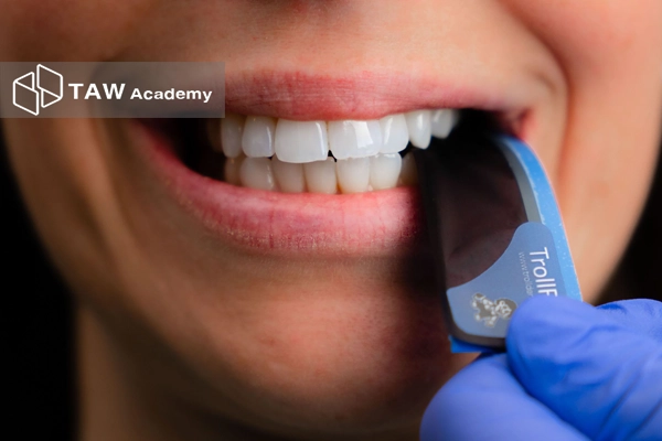 کاربن دندانپزشکی